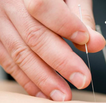 Acupuncture Safety and other Common Misunderstandings